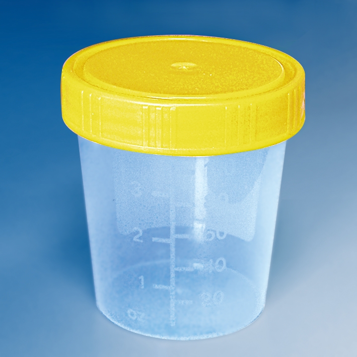 Urinbecher 100 ml mit Schraubdeckel gelb einzeln steril verpackt